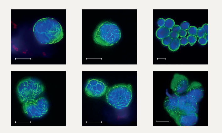 Zu sehen sind Abbildungen von Immunfluoreszenzmikroskopie bei Gilupi