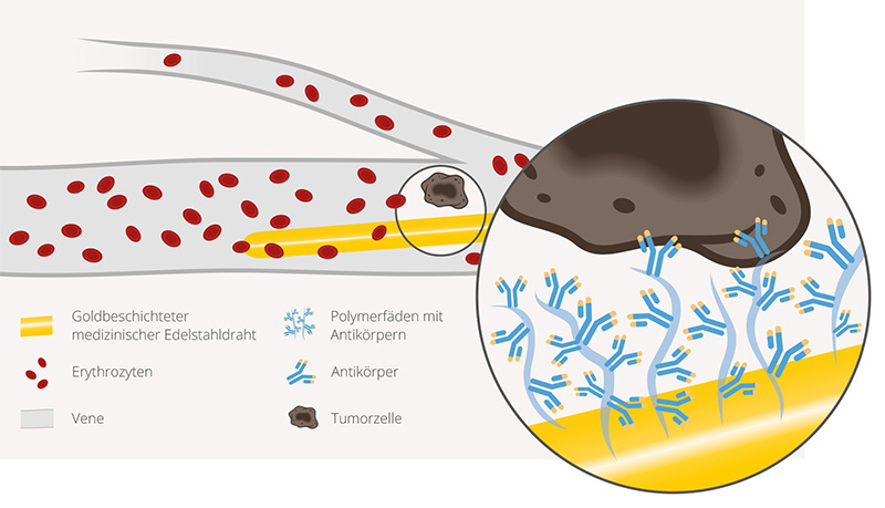 Erklärgrafik zu Tumorzellen in einer Blutvene, Edelstahldraht wird eingesetzt, CellCollector Tumor