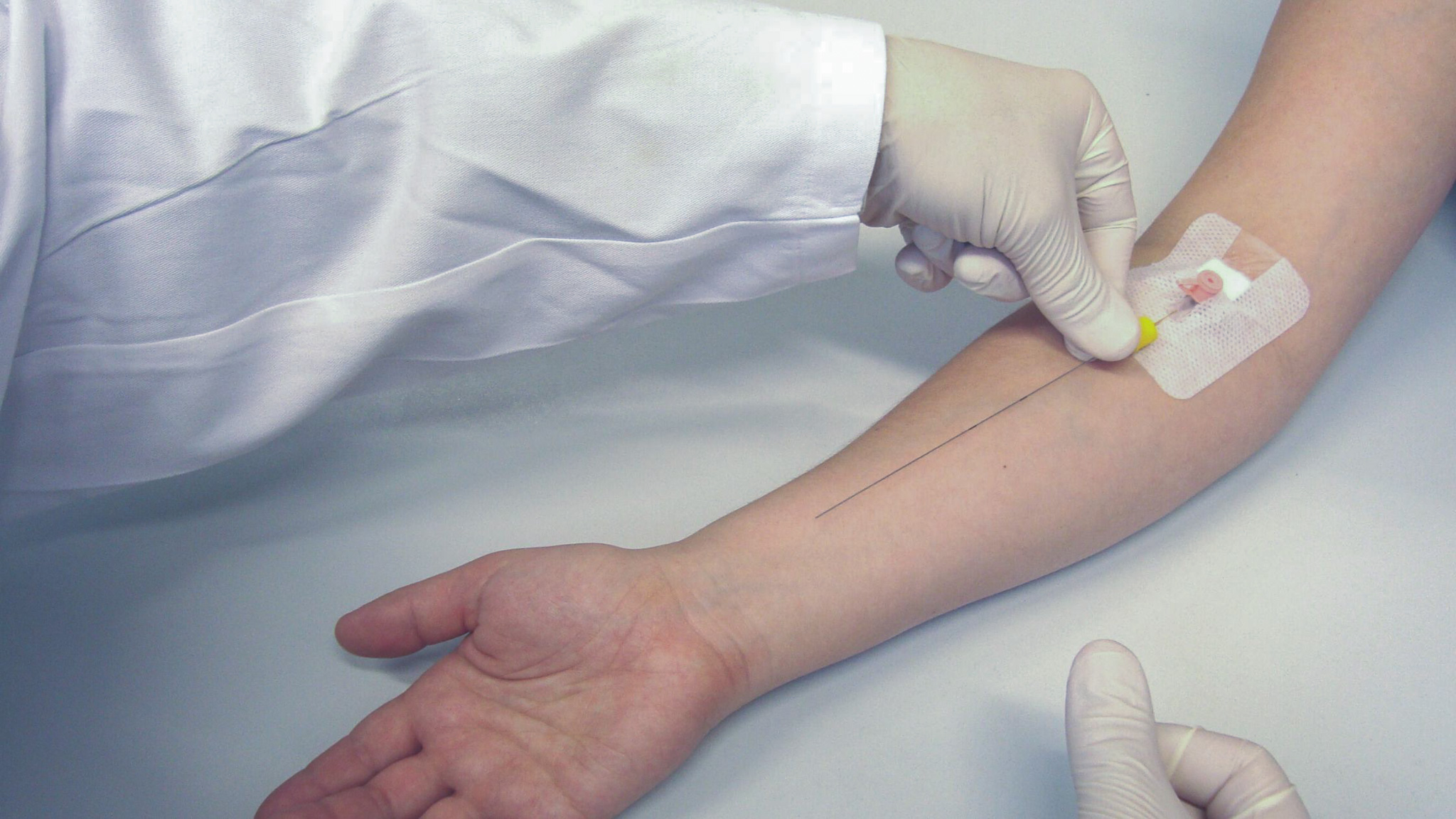 zu sehen ist der Arm eines Patienten dem Blut abgenommen wird von einem Arzt, CellCollector