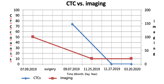 Fallbeispiel Blasenkrebs: CTCs in der Praxis